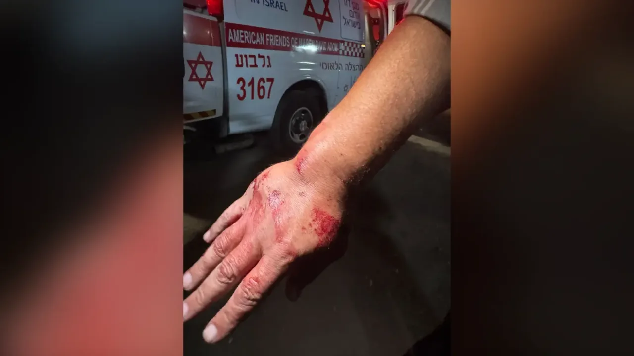 Обложка источника: Жителя Тураана обвинили в жестоком нападении из-за видео в TikTok