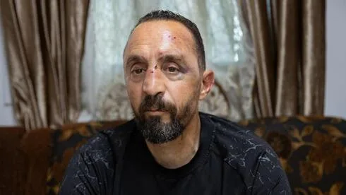 Обложка источника: Водитель автобуса пострадал от нападения